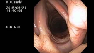 Veterinary Bronchoscopy473 Laryngeal Paralysis Standard Poodle 11y F [upl. by Cathi316]