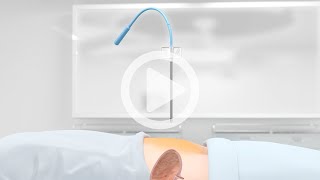 UROmedCYST® »integral« Suprapubic Puncture Set  Insertion of a supra catheter for bladder drainage [upl. by Leshia]