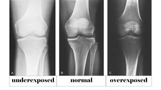 ⚡PART 2 ADJUSTMENT OF RADIOGRAPHIC CONTRAST by 15 and 5 rule [upl. by Sumerlin]