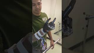 First Bionic Hand in India now Available  Bionic Arm  9773988123 Rehabmitra [upl. by Claire784]