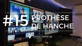 Atout Santé 15 Tout savoir sur la prothèse de la hanche [upl. by Proffitt152]