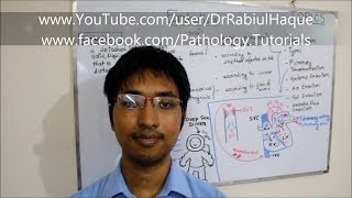 Embolism  Definition Types Pathogenesis Clinical Consequences HD [upl. by Goodman]