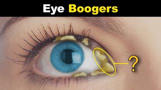 What Are Eye Boogers  Eye Discharge Rheum In Eyes [upl. by Felicity]