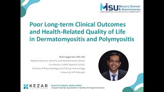 Poor Longterm Clinical Outcomes amp HealthRelated Quality of Life in Dermatomyositis amp Polymyositis [upl. by Shwalb361]