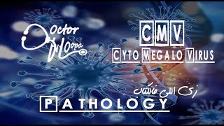 CMV Cyto Megalo Virus   Pathology زي اللي فالكتاب  Doctor HOopa [upl. by Schwab]