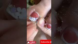 Instructions for Treating Wooden Toenails Indoors How to Groove Your Nails to Eliminate Pain [upl. by Lletnohs780]