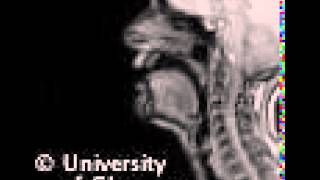 MRI voiced pharyngeal fricative [upl. by Anihtyc]