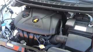 New Hyundai Elantra Sedan Engine Bay Review [upl. by Deirdre802]