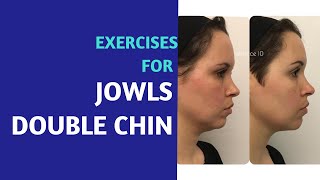 Double Chin Jowls Exercises  Before and After [upl. by Haikan]