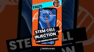 🚨 Revolutionary Stem Cell Injection for Herniated Discs Danny Reveals the Secret 🚨 [upl. by Einnok]