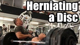 Herniating a Disc During Deadlifts [upl. by Silber]