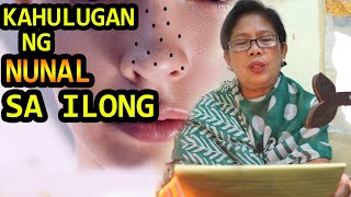 KAHULUGAN NG NUNAL SA ILONG  IBIG SABIHIN MEANING [upl. by Oak801]