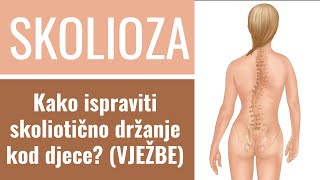 Skolioza kod djece  UZROCI SIMPTOMI I LIJEČENJE Kako ispraviti skoliotično držanje  VJEŽBE [upl. by Yllib]