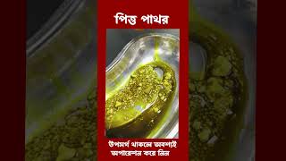 gallstones gallstonessymptoms পিত্তথলিরপাথর [upl. by Inittirb918]