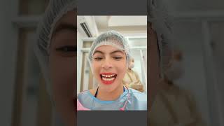 my emax veneers journey 😁 [upl. by Sharity]