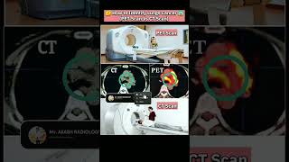 🩻Pet scan Vs CT scan😱 cancer medicalimaging ctscan petscan lungcancer howto youtubeshorts yt [upl. by Morten860]