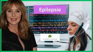 Epilepsie Anfallsformen Ursachen und Behandlung [upl. by Rolanda]