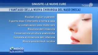 quotIl mio Medicoquot  Sinusite le nuove cure [upl. by Anelaf]