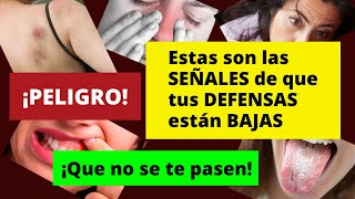 ¡PELIGRO ESTAS SON LAS SEÑALES DE QUE TUS DEFENSAS ESTÁN BAJAS ¡QUE NO SE TE PASEN [upl. by Mccomb]