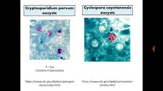 Para Findings 7 Cryptosporidium Cyclospora and Cystisospora in Stool with MZN stain [upl. by Notxam]