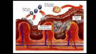 Food Grade Diatomaceous Earth [upl. by Sral735]