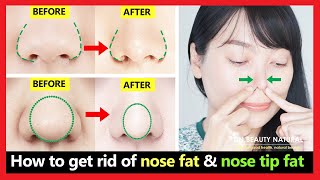 4 Best exercises Get rid of nose fat nose tip fat bulbous nose tip slim down fat nose naturally [upl. by Adey]