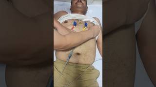 ECG current ने दिल का दौरा पड़ने से बचाया miracle skills trending viralvideo [upl. by Oiuqise]