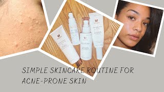 My Simple Weekly Skincare Routine to Moisturize AcneProne Skin [upl. by Stanly459]