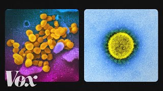 What the coronavirus looks like up close [upl. by Colvert]