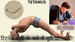 Tetanus Symptoms Treatment  Why Should You Take Tetanus Vaccine  Tetanus In Baby Patient Live IPD [upl. by Risan297]