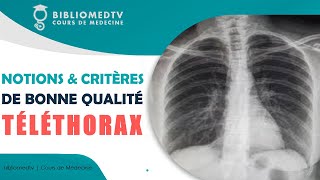 Radiographie du Thorax  Notions et Critères de Bonne Qualité [upl. by Esil563]