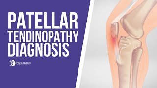 How to Diagnose Patellar Tendinopathy  Jumpers Knee Diagnosis [upl. by Eirb]