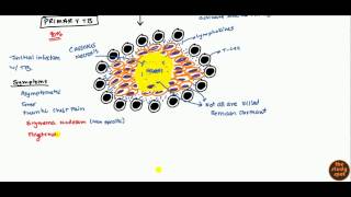 Tuberculosis for USMLE Step 1 and USMLE Step 2 [upl. by Rentschler]