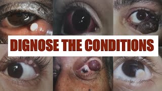 PATHOLOGICAL EYE CONDITIONS 1 Ophthalmology Osce [upl. by Shumway]