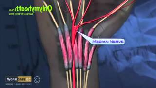 What is Carpal Tunnel Syndrome  Onlymyhealthcom [upl. by Tnelc893]