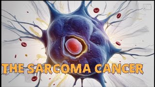 Understanding Sarcoma Cancer Causes Prevention and Remedies [upl. by Warram914]