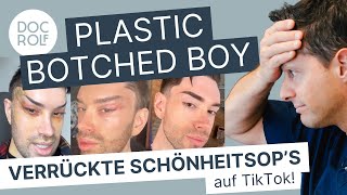 Plastic Botched Boy SOCIAL MEDIA  KÖRPERDYSMORPHE STÖRUNG – docrolf reagiert [upl. by Ester]