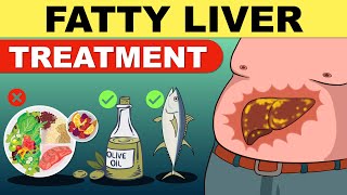 Fatty Liver Treatment  Fatty Liver Diet  Liver Detox  Fatty Liver  Fatty Liver Symptoms [upl. by Leeland433]