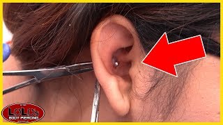 This Conch Piercing Looks BAD Removal [upl. by Shoshanna135]