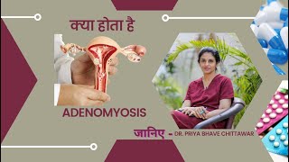 क्या होता है Adenomyosis जानिए Dr Priya Bhave Chittawar [upl. by Beauvais]