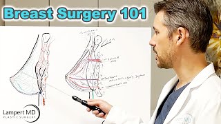 Breast Surgery 101 with Dr Lampert [upl. by Enneyehs]