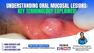 TERMINOLOGYORAL MUCOSAL LESIONS [upl. by Gregor16]