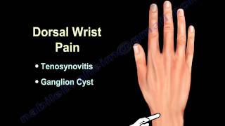 WRIST PAIN COMMON CAUSES  Everything You Need To Know  Dr Nabil Ebraheim [upl. by Westbrook778]