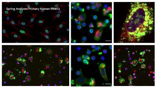 A multiphenotype system to discovery therapies for dysregulated immune response [upl. by Ainnek]