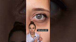 How To Get Rid Of Dark Circles Under Your Eyes dermatologist [upl. by Crofoot]