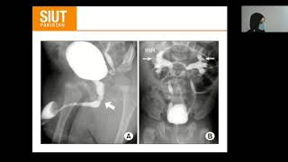 Urological investigation 03 Cystogram Urethrogram Antrograde Transrectal Ultrasound [upl. by Newfeld873]