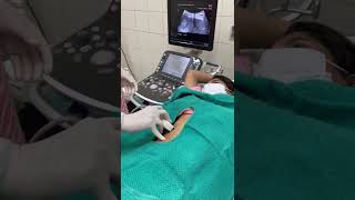 Liver Abscess Aspiration Procedure [upl. by Josias73]