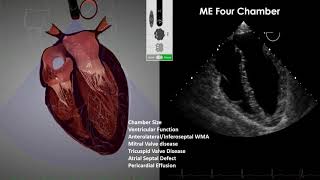 Transesophageal Echocardiography TEE Imaging [upl. by Aelc661]