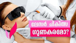 Laser Treatment for skin  ലേസര്‍ ചികിത്സ  Dr Vimi  Beauty Touch by Dr Vimi [upl. by Cerelia]