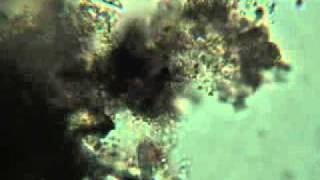 Fish Tank Filter Organisms Under a Microscopeflv [upl. by Seem638]